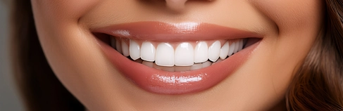 Urla gülüş tasarımı sonrası doğal beyaz dişli kadın gülümsemesi – HBA Dent