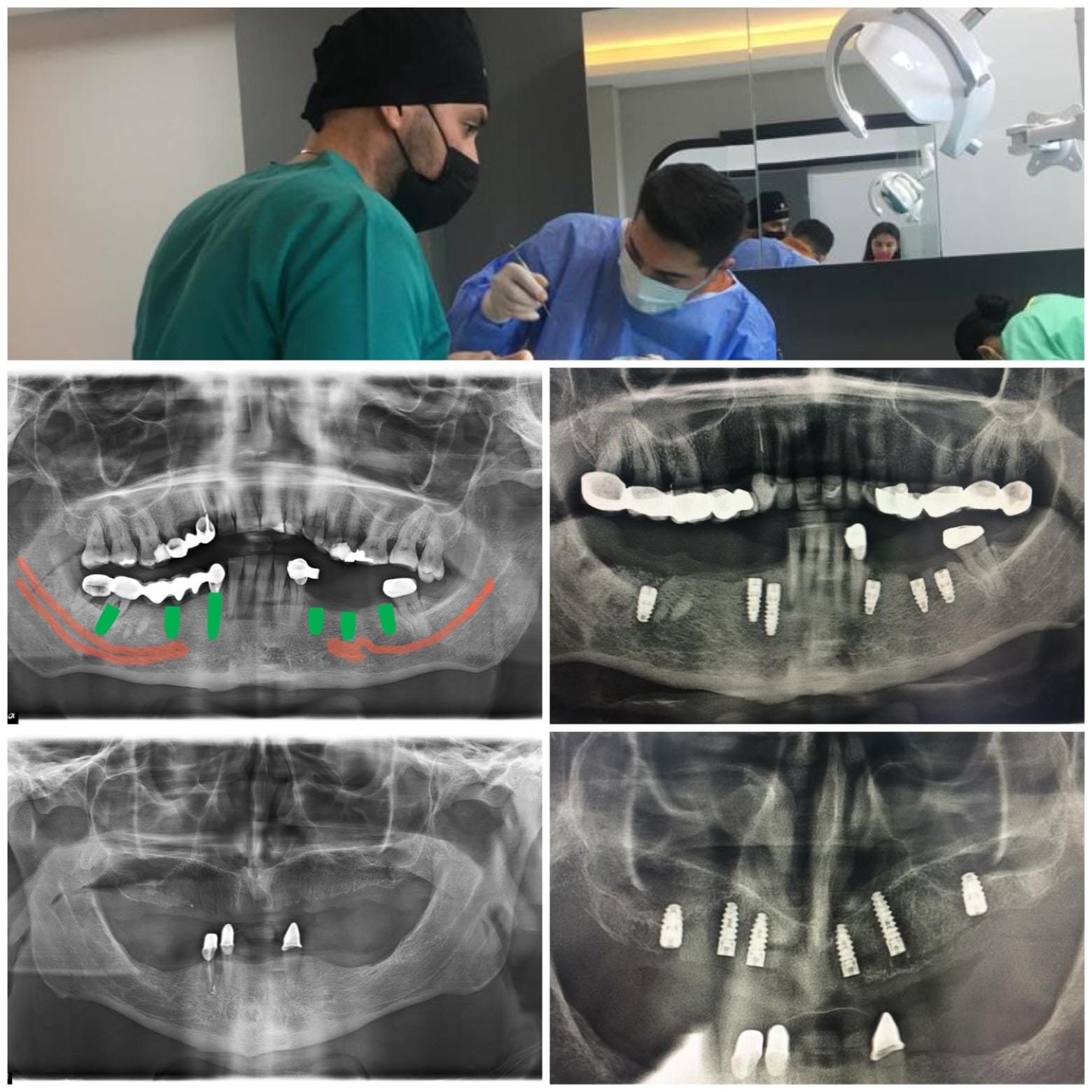 HBADent Urla’da dijital diş röntgeni ve modern görüntüleme alanı