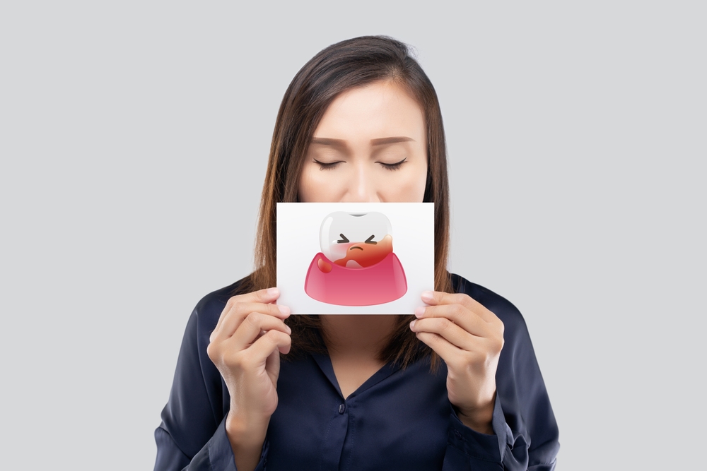 Plak ve tartar birikimi