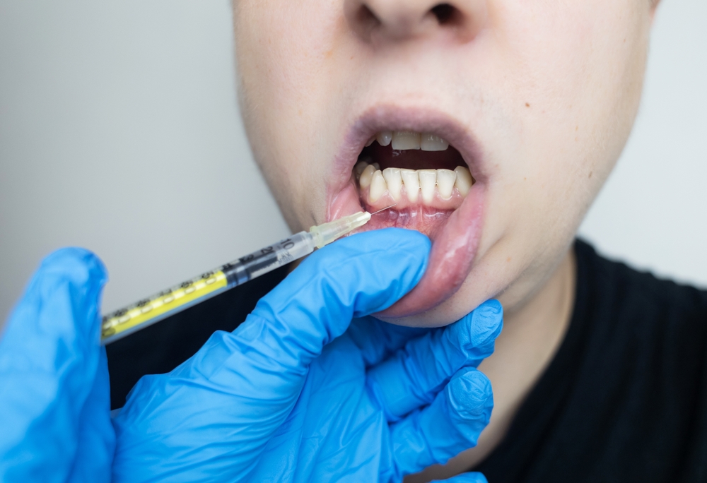 Diş eti çekilmesi nedenleri