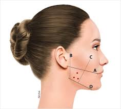 İzmir bruksizm ve masseter botoksu